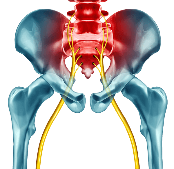 Sciatica: Signs & Symptoms - Back & Joint Rehab Center Crown Point Indiana